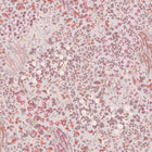 142357 Painterly Flora Pink Wallpaper by Graham & Brown